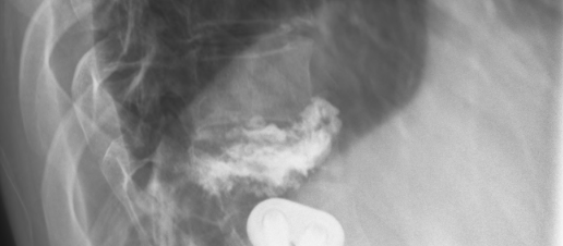 Spine