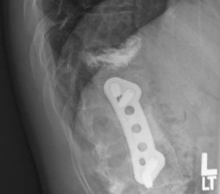 Spine
