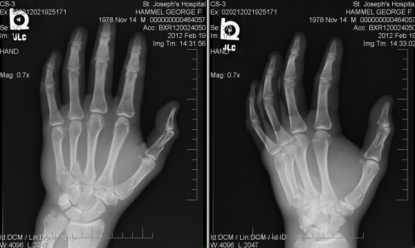 xray